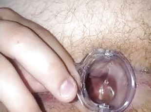 Anal gape with tools. Obgyn speculum inspection.