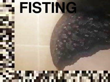 Anal fisting