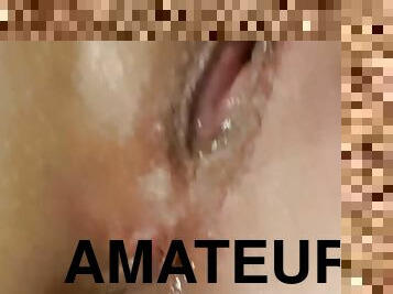 Anal gaping