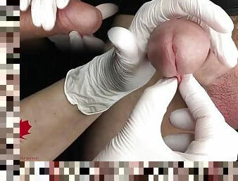 Medical examination of the urethra and collection of a sperm sample. PiP swap - View II